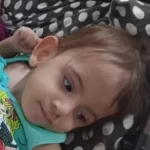 Aruna, gêmea siamesa separada em Goiânia, passa por nova cirurgia em São Paulo.