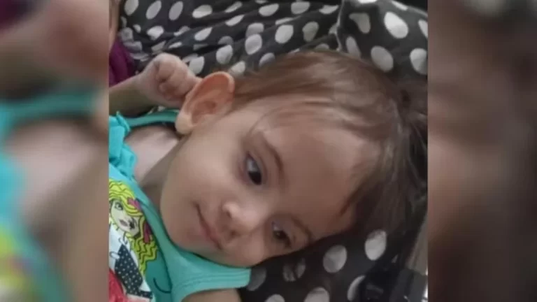Aruna, gêmea siamesa separada em Goiânia, passa por nova cirurgia em São Paulo.