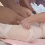 Laboratório nega responsabilidade por fratura em bebê durante teste do pezinho, em Aparecida.