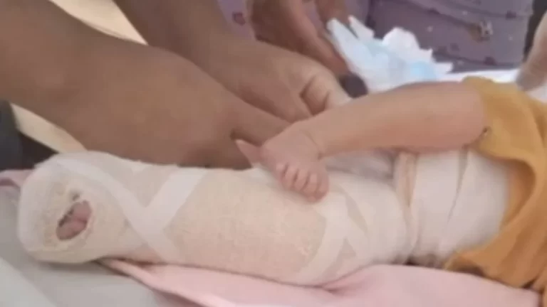 Laboratório nega responsabilidade por fratura em bebê durante teste do pezinho, em Aparecida.