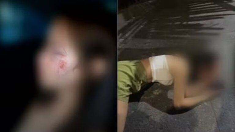 Mulher é agredida na saída de boate em Goiânia